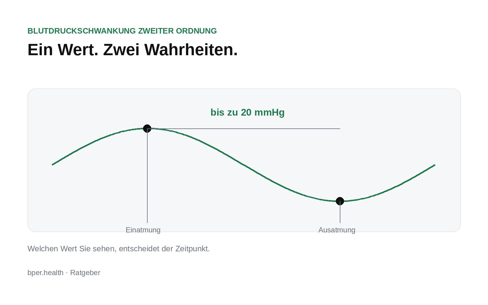 Kurvendiagramm: Der Blutdruck schwankt im Atemrhythmus zwischen zwei Messwerten – beide sind korrekt gemessen.