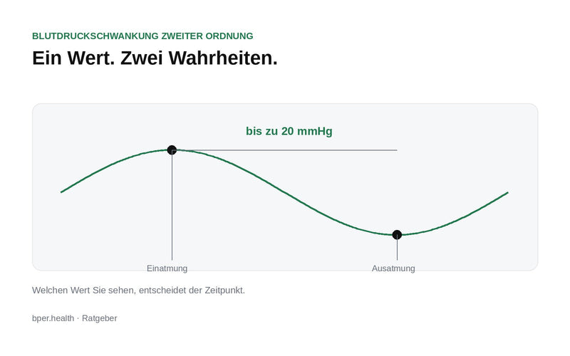 Kurvendiagramm: Der Blutdruck schwankt im Atemrhythmus zwischen zwei Messwerten – beide sind korrekt gemessen.